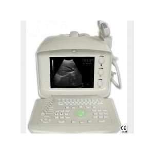    HEALTHPOWER Digital ultrasound Scanner OB / GYN Electronics