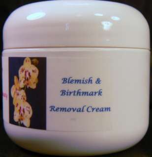 Fade Away Skin Lightener Birthmark Discoloration Cream  