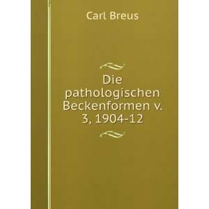  Die pathologischen Beckenformen v. 3, 1904 12 Carl Breus Books